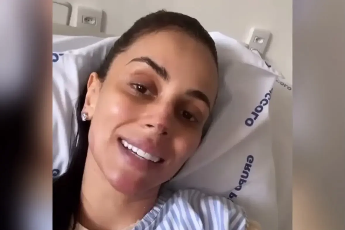 Médica queimada em explosão de lancha deixa UTI em Goiânia