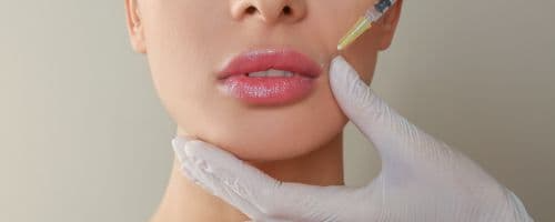 Perigo estético: SBD-GO e CFM pedem proibição do PMMA após morte em Goiânia